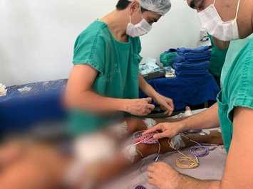 Hospital Infantil e HGV realizam triagem nesta terça-feira (15) para mutirão de cirurgias para crianças e adolescentes